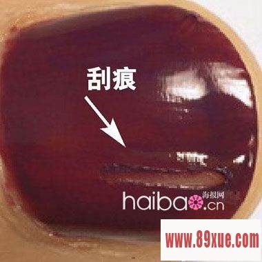 补救指甲油