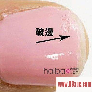补救指甲油